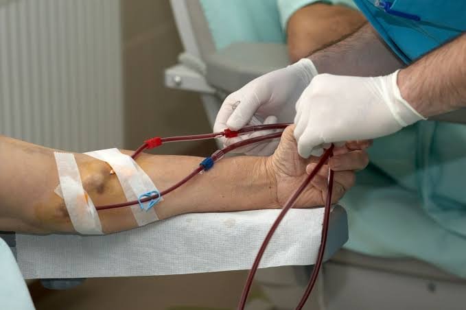 Understanding the Different Types of Dialysis Access